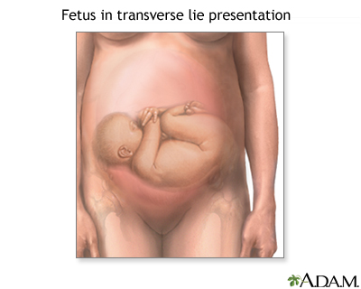 images of babies in womb. +positions+in+the+womb